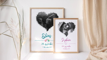 Baby Ultraschallbild als personalisiertes Poster