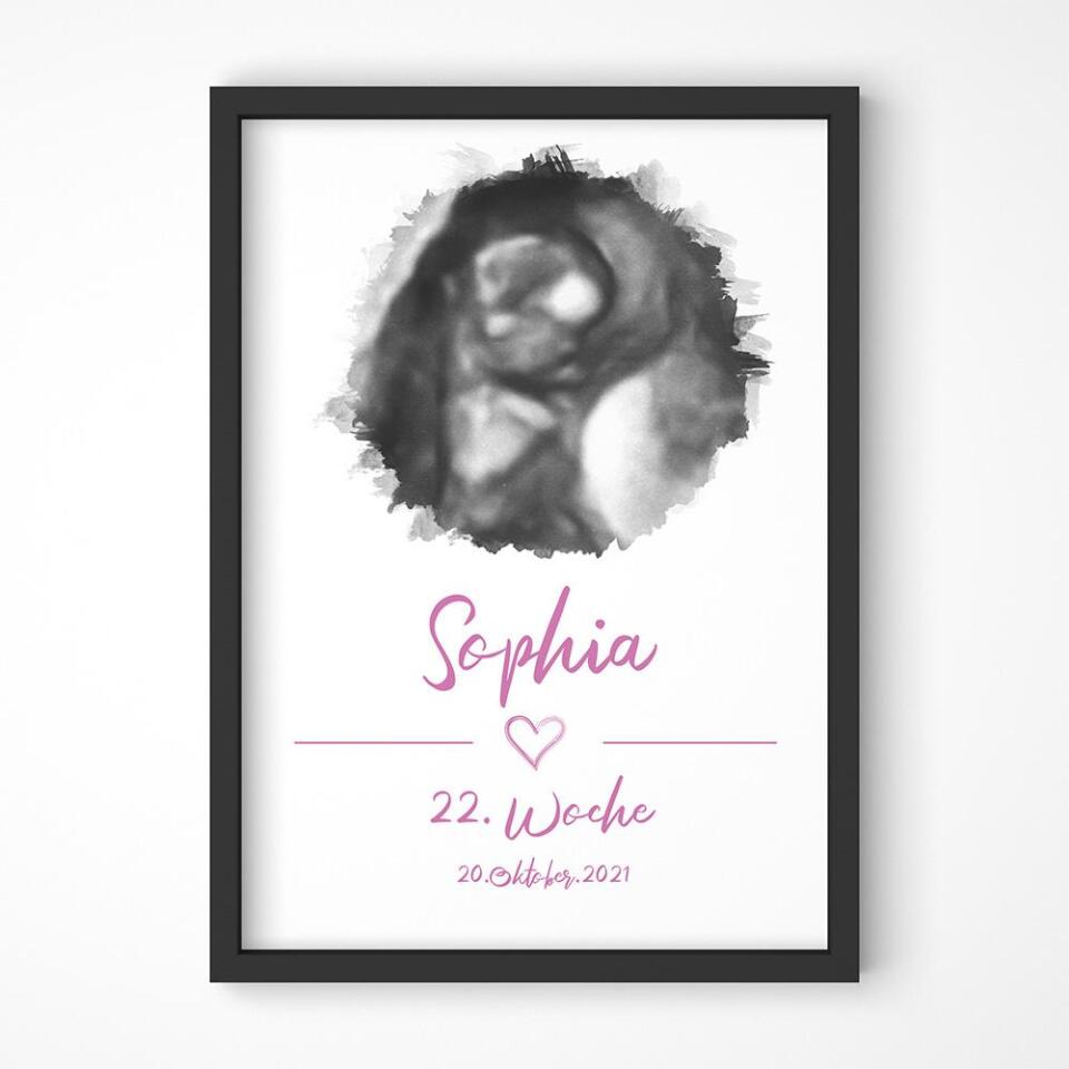 Ultraschallbild personalisiert • Baby Poster mit Foto, Name, Datum und Wunschtext • Geschenk zur Schwangerschaft oder Babyerinnerung