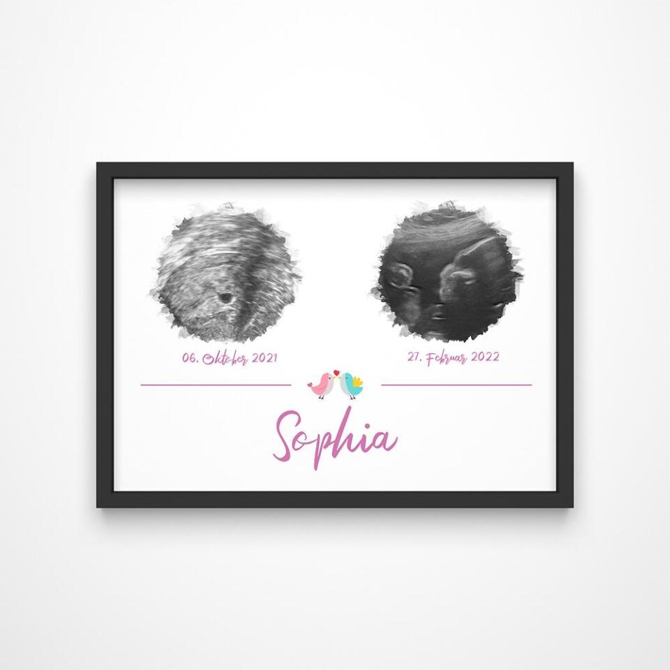 Personalisiertes Ultraschall Geschenk • Poster mit 2 Babybildern • Erinnerung an Schwangerschaft & Babyglück