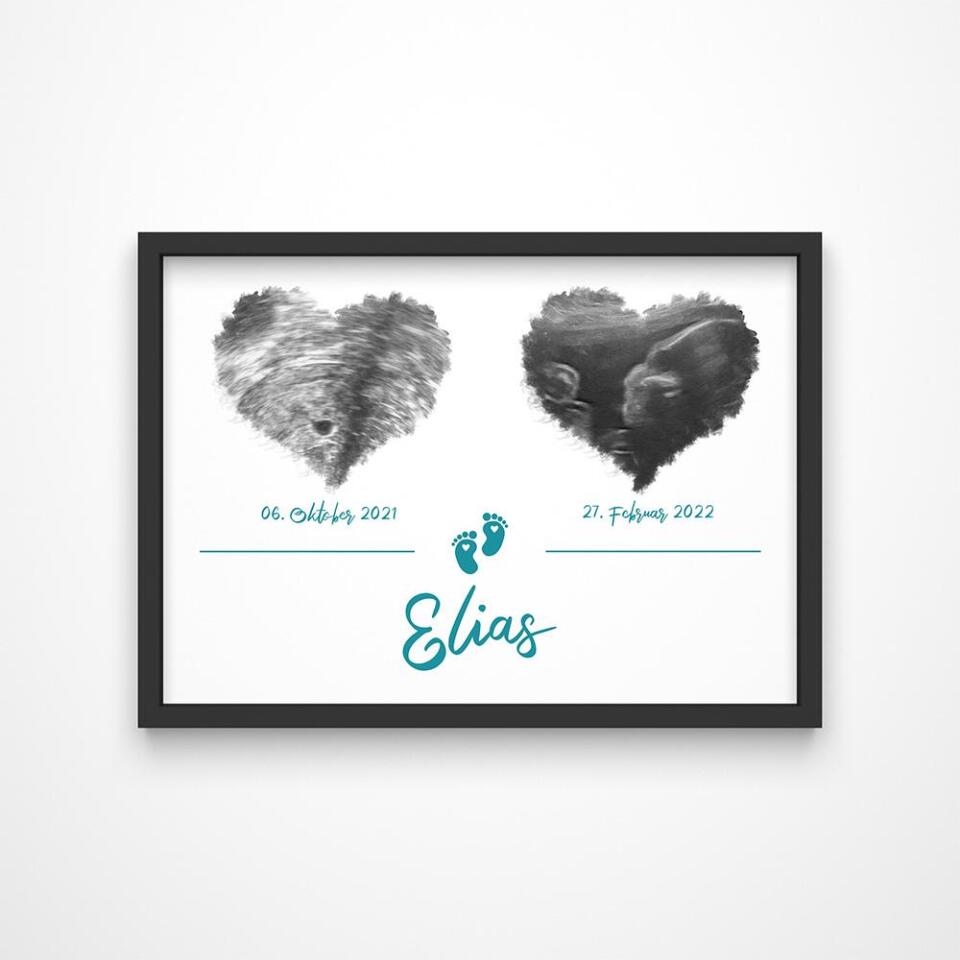 Ultraschall Poster Herz mit 2 Bildern • Personalisiertes Babybild mit Name, Datum • Geschenk zur Schwangerschaft oder Geburt