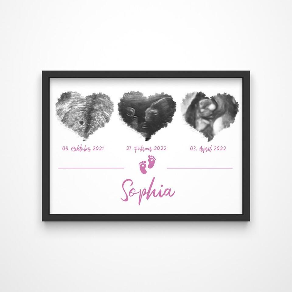 Ultraschallbild Herz mit 3 Bildern personalisiert • Geschenk zur Schwangerschaft • Baby Poster mit Name und Datum als Erinnerung