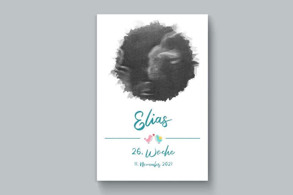 Ultraschallbild personalisiert • Baby Poster mit Foto, Name, Datum und Wunschtext • Geschenk zur Schwangerschaft oder Babyerinnerung