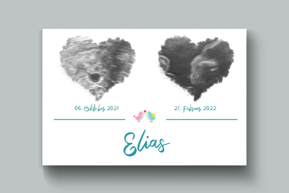 Ultraschall Poster Herz mit 2 Bildern • Personalisiertes Babybild mit Name, Datum • Geschenk zur Schwangerschaft oder Geburt