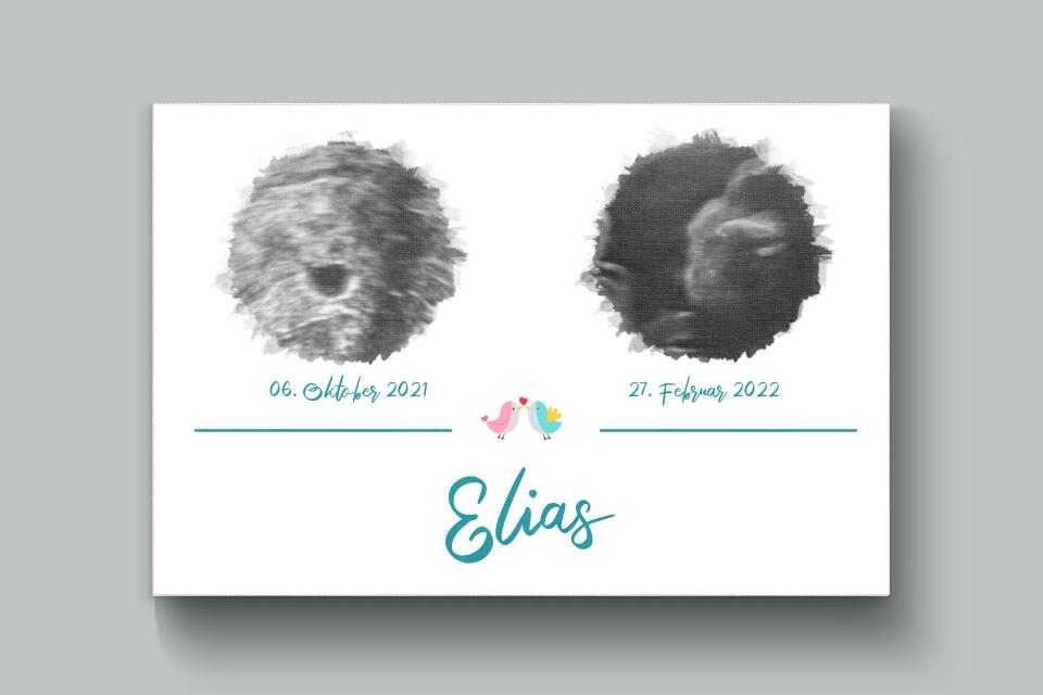 Personalisiertes Ultraschall Geschenk • Poster mit 2 Babybildern • Erinnerung an Schwangerschaft & Babyglück