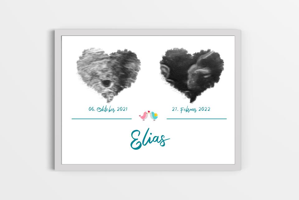 Ultraschall Poster Herz mit 2 Bildern • Personalisiertes Babybild mit Name, Datum • Geschenk zur Schwangerschaft oder Geburt