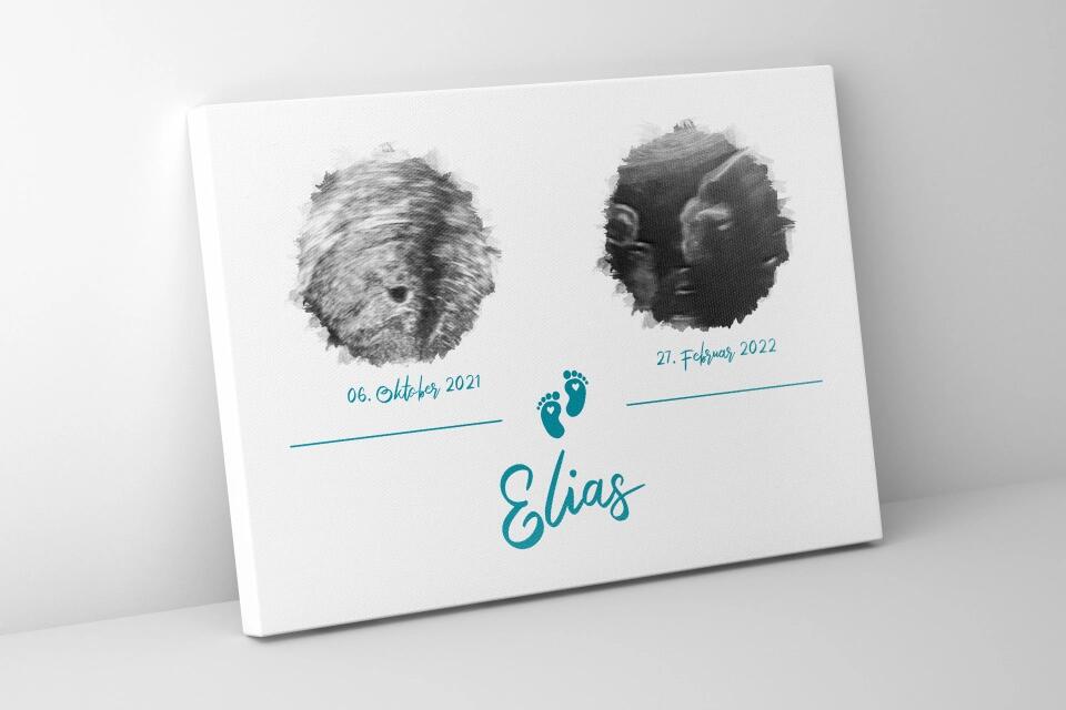 Personalisiertes Ultraschall Geschenk • Poster mit 2 Babybildern • Erinnerung an Schwangerschaft & Babyglück