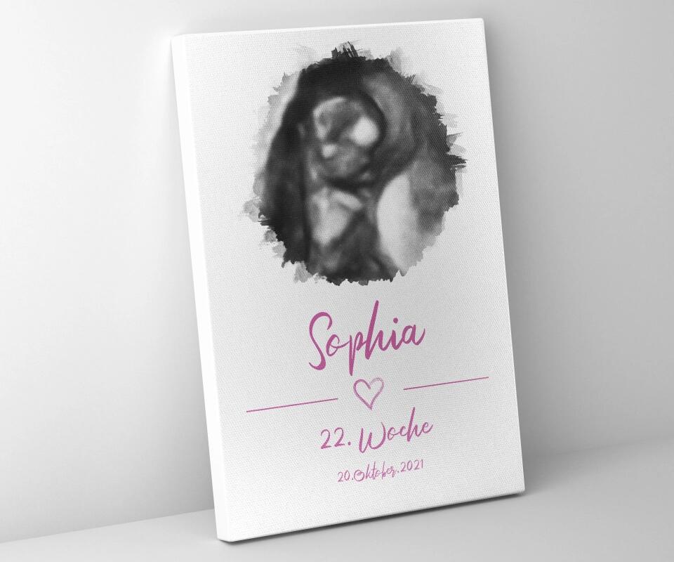 Ultraschallbild personalisiert • Baby Poster mit Foto, Name, Datum und Wunschtext • Geschenk zur Schwangerschaft oder Babyerinnerung